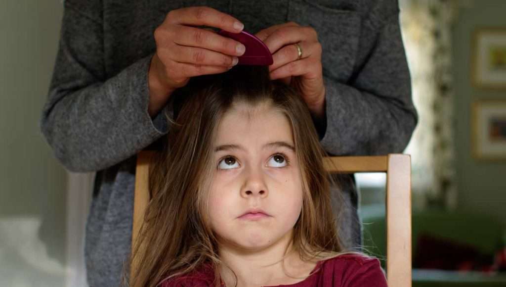 head lice