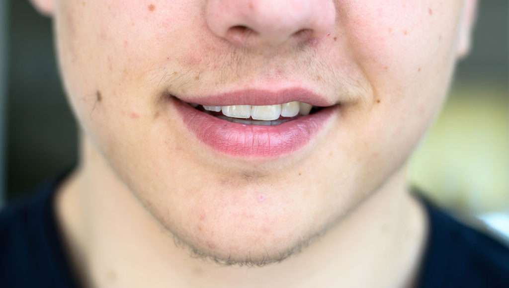man cant grown beard